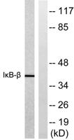 IκB-β Polyclonal Antibody