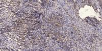 IκB-β Polyclonal Antibody