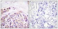 IκB-ε Polyclonal Antibody