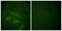 IκB-ε Polyclonal Antibody
