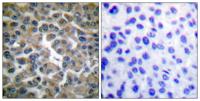 IκB-ε Polyclonal Antibody