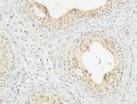 JAB1 Polyclonal Antibody