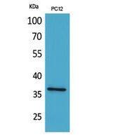 JAM-A Polyclonal Antibody