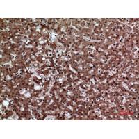 JAM-A Polyclonal Antibody