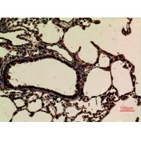 JAM-B Polyclonal Antibody