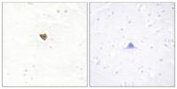 Jamip2 Polyclonal Antibody