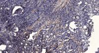 JDP2 Polyclonal Antibody