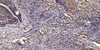JIK Polyclonal Antibody