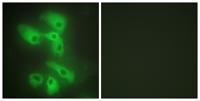 JIP-2 Polyclonal Antibody
