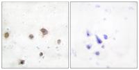 JIP-2 Polyclonal Antibody
