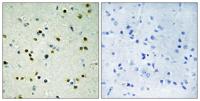 JMJD2B Polyclonal Antibody
