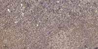 JNK2 Polyclonal Antibody