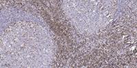 JNK3 Polyclonal Antibody