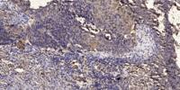 JTB Polyclonal Antibody