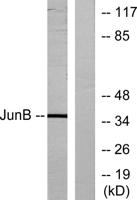 Jun B Polyclonal Antibody