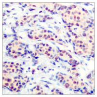 Jun D Polyclonal Antibody