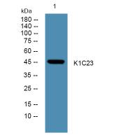 K1C23 Polyclonal Antibody
