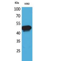 Kallistatin Polyclonal Antibody