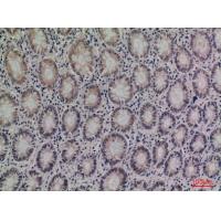 Kallistatin Polyclonal Antibody
