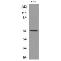 Kallistatin Polyclonal Antibody