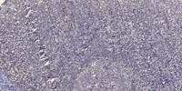 Kanadaptin Polyclonal Antibody