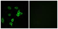 KANK2 Polyclonal Antibody
