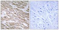 KANK2 Polyclonal Antibody