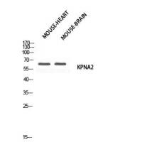 Karyopherin α2 Polyclonal Antibody