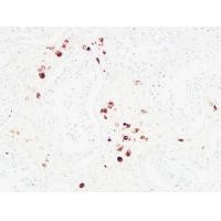 Karyopherin α2 Polyclonal Antibody