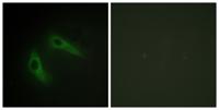 KChIP1 Polyclonal Antibody