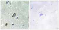 KChIP1 Polyclonal Antibody