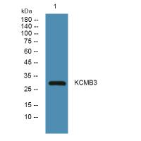 KCMB3 Polyclonal Antibody