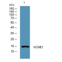 KCNE1 Polyclonal Antibody