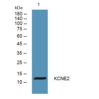 KCNE2 Polyclonal Antibody