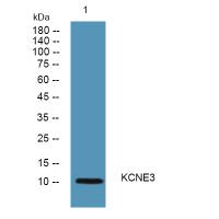 KCNE3 Polyclonal Antibody