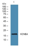 KCNE4 Polyclonal Antibody