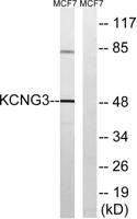 KCNG3 Polyclonal Antibody