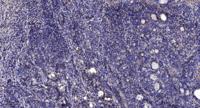 KCNH3 Polyclonal Antibody