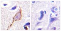 KCNQ2/3/4/5 Polyclonal Antibody
