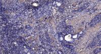 KCNQ5 Polyclonal Antibody