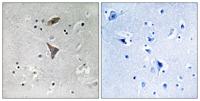 KCNT1 Polyclonal Antibody