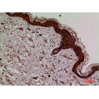 Keap-1 Polyclonal Antibody