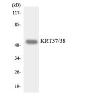Keratin 37/38 Polyclonal Antibody