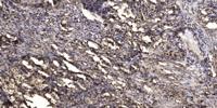 Keratin 37/38 Polyclonal Antibody