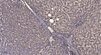 Keratin 5 Polyclonal Antibody