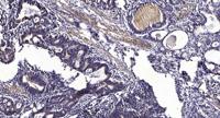 Keratin 8 Polyclonal Antibody
