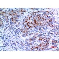 Keratin-pan Polyclonal Antibody