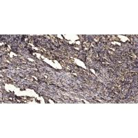 Keratin-pan Polyclonal Antibody