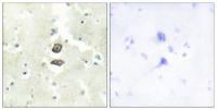 KG19 Polyclonal Antibody