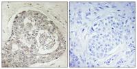 KIAA0100 Polyclonal Antibody